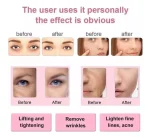 Maquina Elevacion Facial Rejuvenecimiento Masaje Facial - Imagen 5