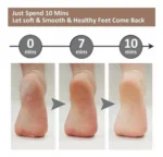 Maquina Removedora De Callos De Pie Electrico Recargable - Angeles del Hogar Chile